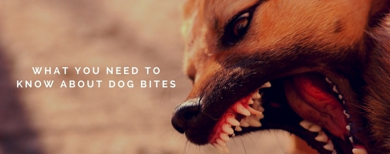 what you need to know about dog bites